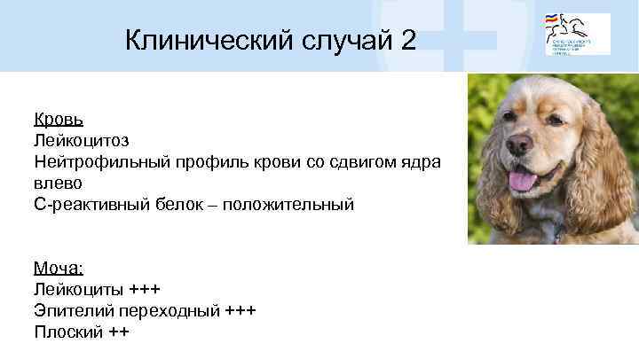 Клинический случай 2 Кровь Лейкоцитоз Нейтрофильный профиль крови со сдвигом ядра влево С-реактивный белок