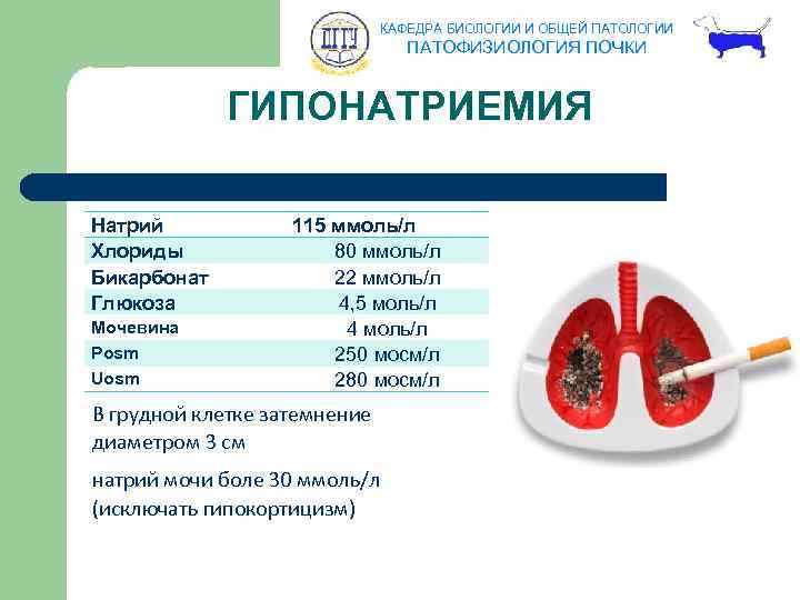 КАФЕДРА БИОЛОГИИ И ОБЩЕЙ ПАТОЛОГИИ ПАТОФИЗИОЛОГИЯ ПОЧКИ ГИПОНАТРИЕМИЯ Натрий Хлориды Бикарбонат Глюкоза Мочевина Рosm