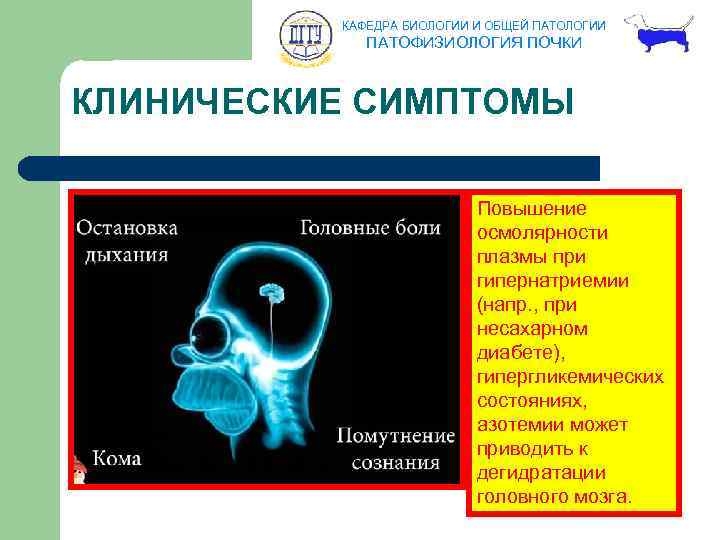 КАФЕДРА БИОЛОГИИ И ОБЩЕЙ ПАТОЛОГИИ ПАТОФИЗИОЛОГИЯ ПОЧКИ КЛИНИЧЕСКИЕ СИМПТОМЫ Повышение осмолярности плазмы при гипернатриемии