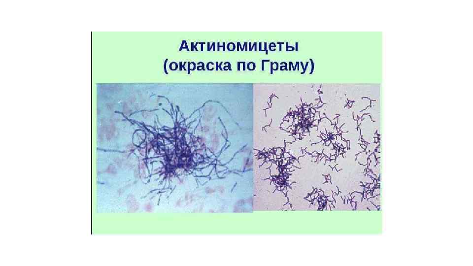 Актиномицеты микробиология презентация