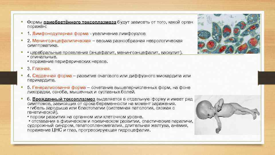  • Формы приобретённого токсоплазмоза будут зависеть от того, какой орган токсоплазмоза поражён: •