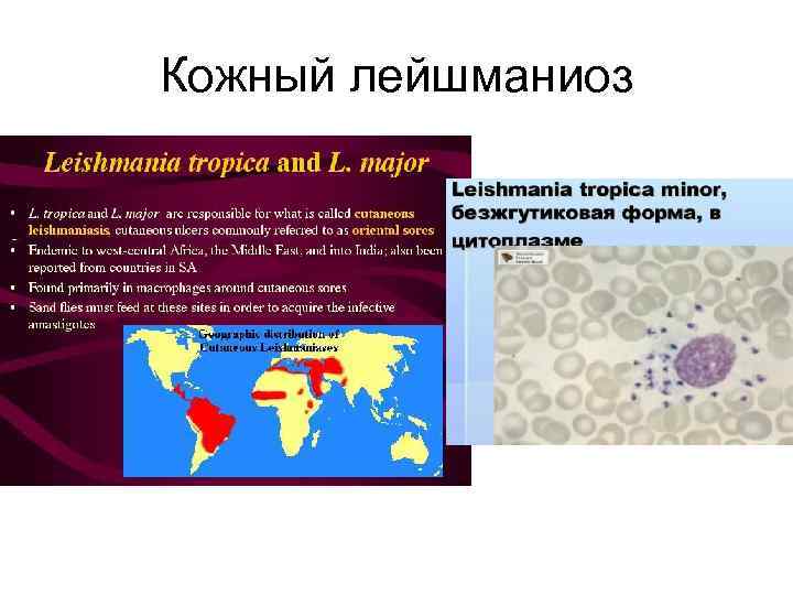 Кожный лейшманиоз 