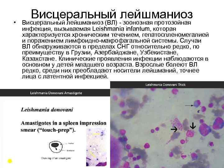 Висцеральный лейшманиоз • Висцеральный лейшманиоз (ВЛ) зоонозная протозойная инфекция, вызываемая Leishmania infantum, которая характеризуется