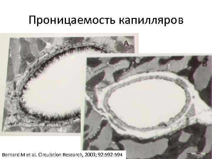 Проницаемость капилляров Bernard M et al. Circulation Research, 2003; 92: 592 -594 