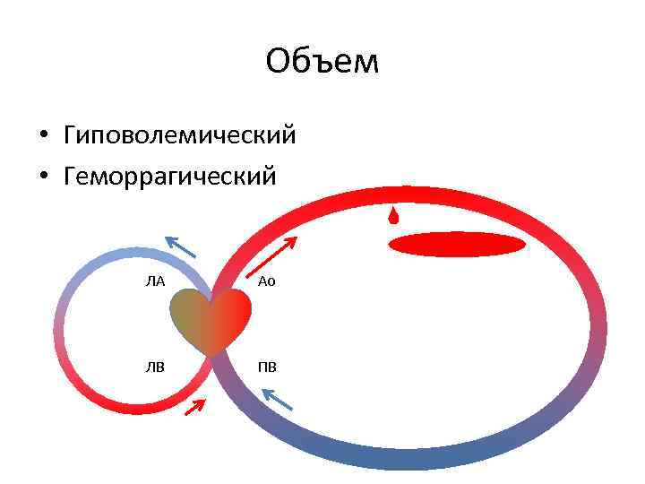 Объем • Гиповолемический • Геморрагический ЛА Ао ЛВ ПВ 