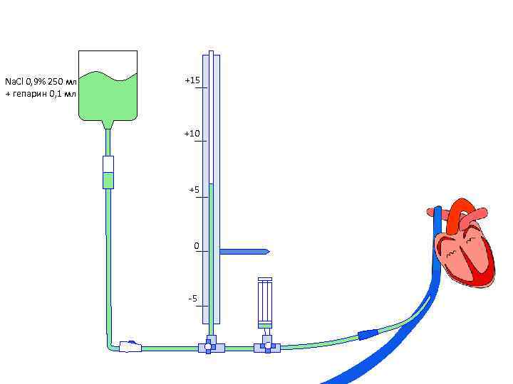 Na. Cl 0, 9% 250 мл + гепарин 0, 1 мл +15 +10 +5