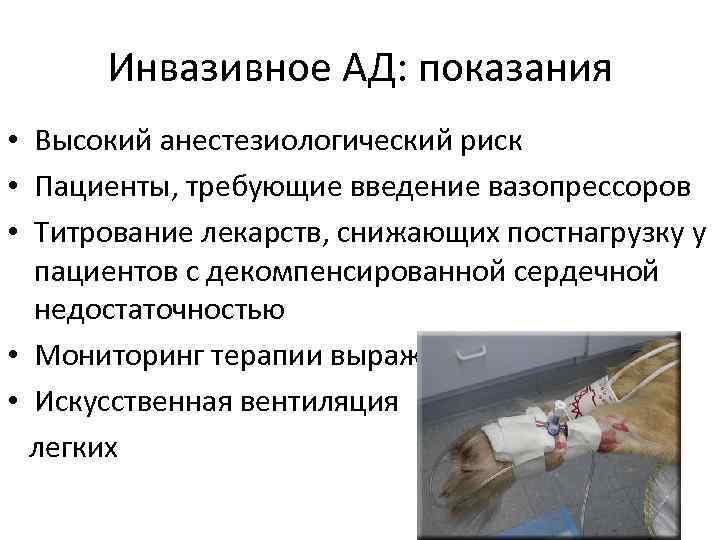 Инвазивное АД: показания • Высокий анестезиологический риск • Пациенты, требующие введение вазопрессоров • Титрование