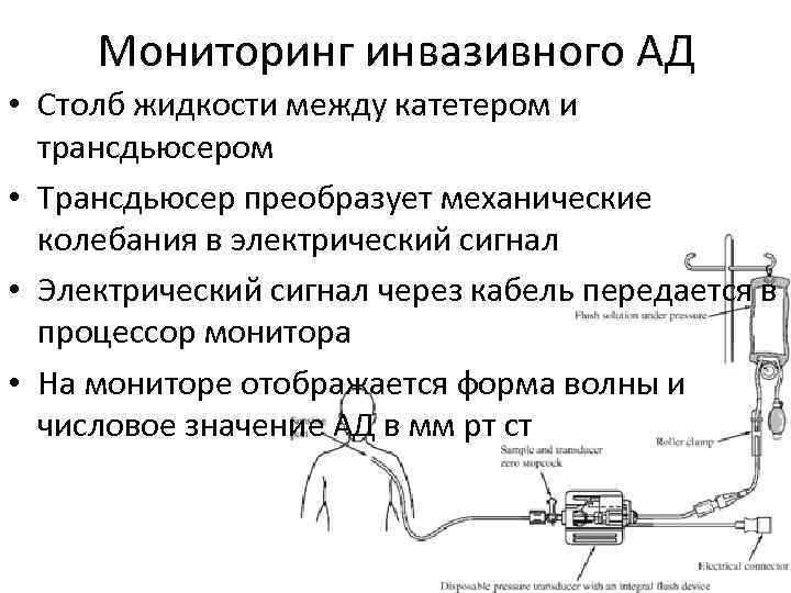 Мониторинг инвазивного АД • Столб жидкости между катетером и трансдьюсером • Трансдьюсер преобразует механические