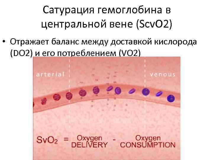 Сатурация гемоглобина в центральной вене (Scv. O 2) • Отражает баланс между доставкой кислорода