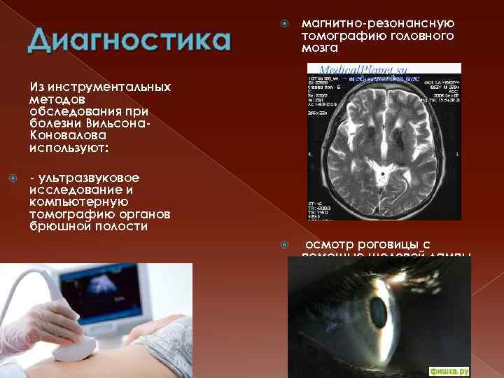 Диагностика магнитно-резонансную томографию головного мозга осмотр роговицы с помощью щелевой лампы Из инструментальных методов