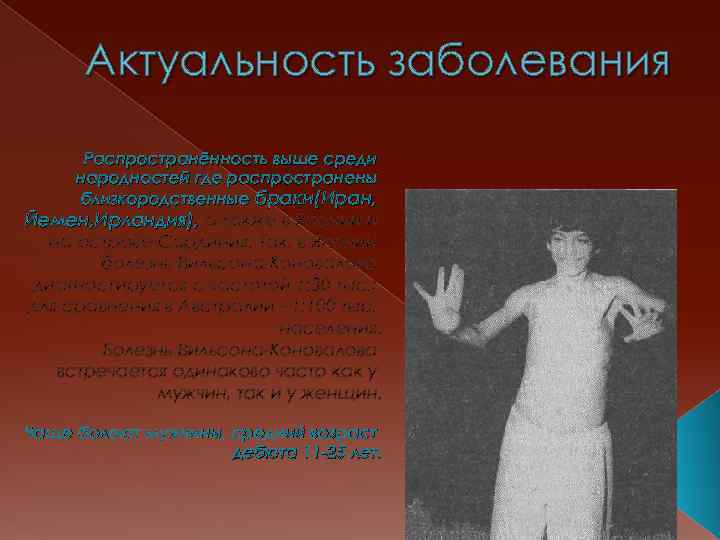 Актуальность заболевания Распространённость выше среди народностей где распространены близкородственные браки(Иран, Йемен, Ирландия), а также