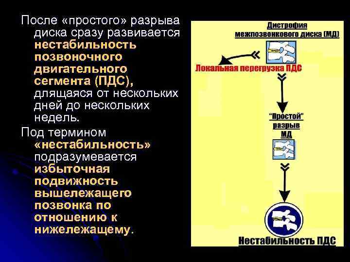 После «простого» разрыва диска сразу развивается нестабильность позвоночного двигательного сегмента (ПДС), длящаяся от нескольких