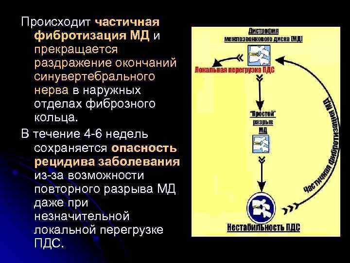 Происходит частичная фибротизация МД и прекращается раздражение окончаний синувертебрального нерва в наружных отделах фиброзного