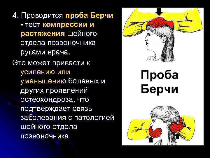 4. Проводится проба Берчи - тест компрессии и растяжения шейного отдела позвоночника руками врача.