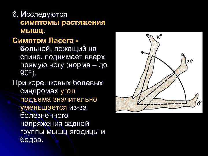 6. Исследуются симптомы растяжения мышц. Симптом Ласега больной, лежащий на спине, поднимает вверх прямую