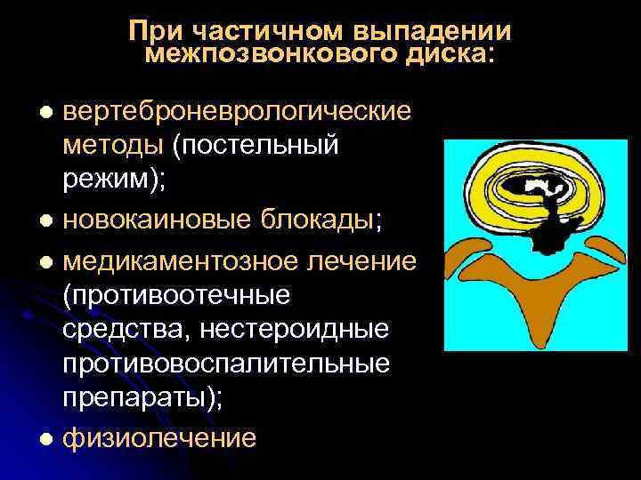 При частичном выпадении межпозвонкового диска: вертеброневрологические методы (постельный режим); l новокаиновые блокады; l медикаментозное