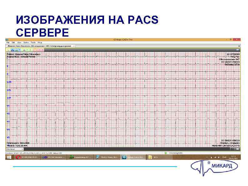 ИЗОБРАЖЕНИЯ НА PACS СЕРВЕРЕ 