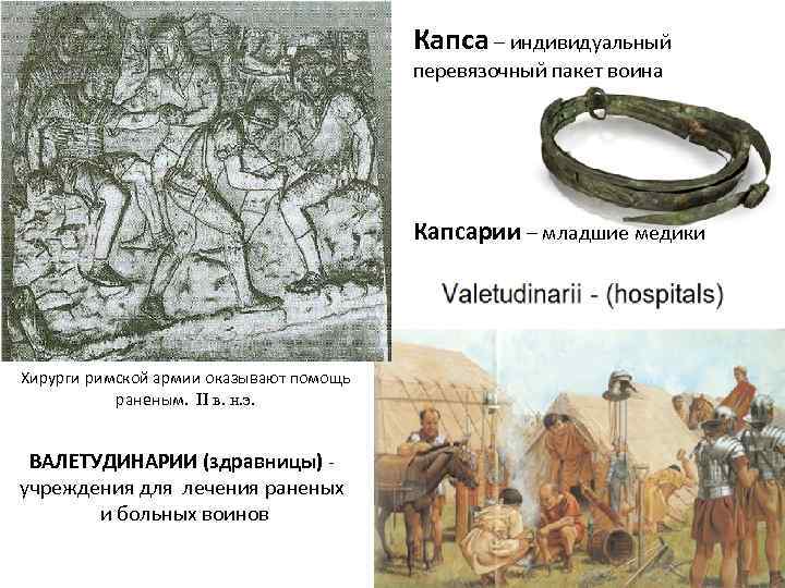 Капса – индивидуальный перевязочный пакет воина Капсарии – младшие медики Хирурги римской армии оказывают