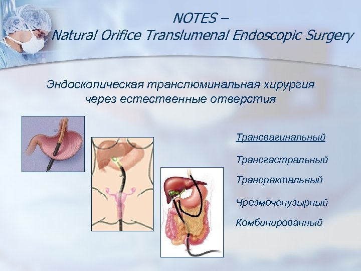 Транслюминальная хирургия презентация