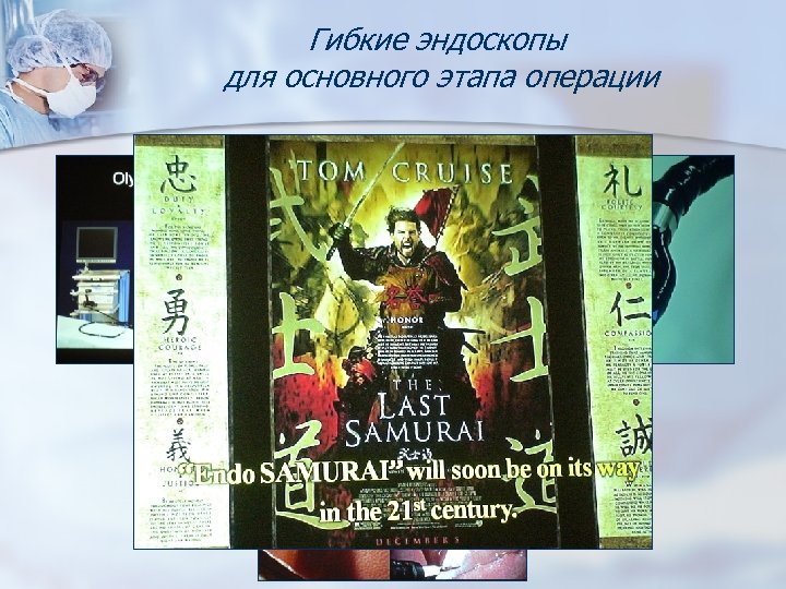 Гибкие эндоскопы для основного этапа операции 