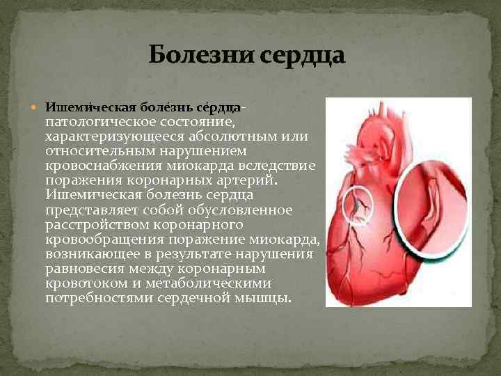 Болезни сердца Ишеми ческая боле знь се рдца патологическое состояние, характеризующееся абсолютным или относительным