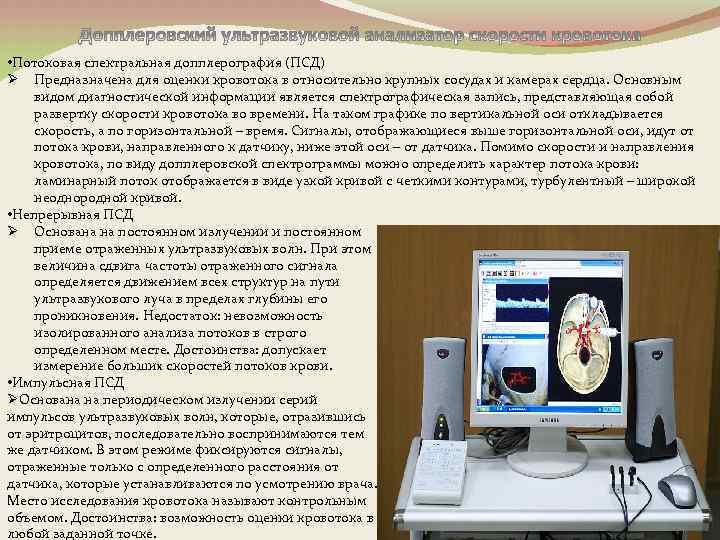  • Потоковая спектральная допплерография (ПСД) Ø Предназначена для оценки кровотока в относительно крупных