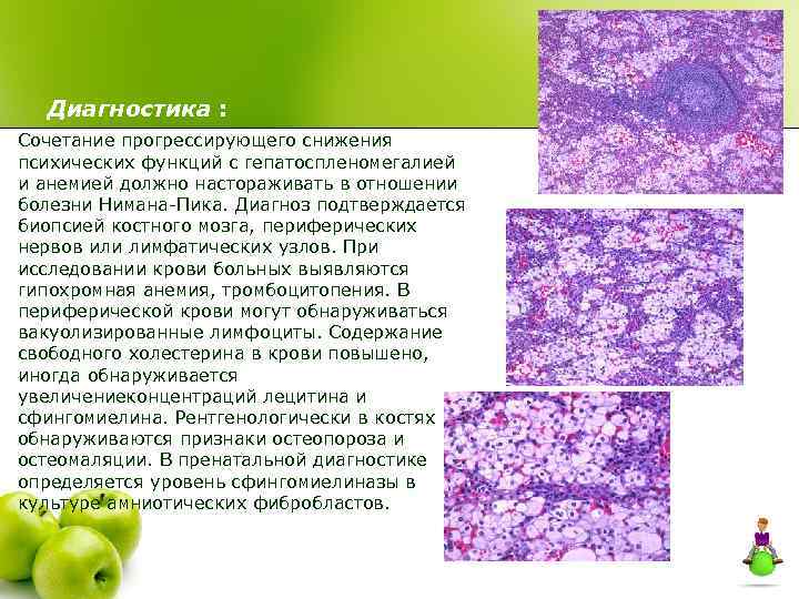 Диагностика : Сочетание прогрессирующего снижения психических функций с гепатоспленомегалией и анемией должно настораживать в