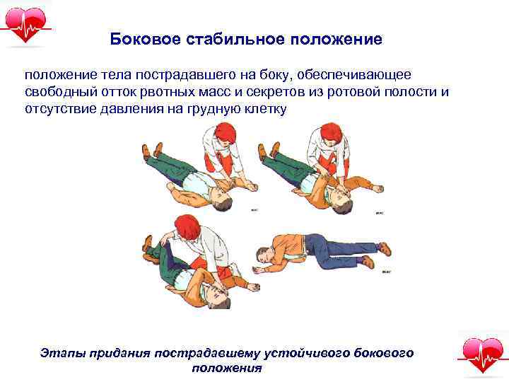 Боковое стабильное положение тела пострадавшего на боку, обеспечивающее свободный отток рвотных масс и секретов