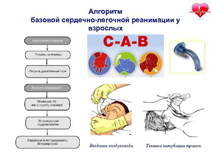 По какой схеме производятся реанимационные действия