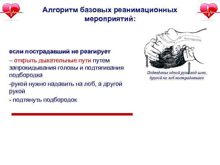 Алгоритм базовых реанимационных мероприятий: если пострадавший не реагирует – открыть дыхательные пути путем запрокидывания