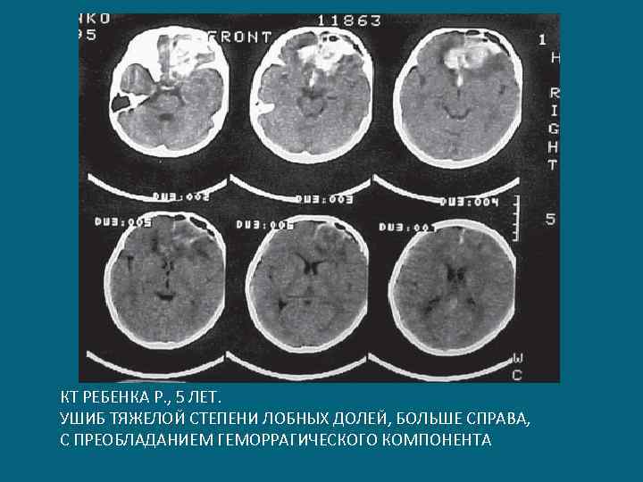 Кт детям отзывы