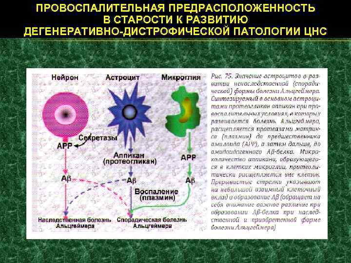 ПРОВОСПАЛИТЕЛЬНАЯ ПРЕДРАСПОЛОЖЕННОСТЬ В СТАРОСТИ К РАЗВИТИЮ ДЕГЕНЕРАТИВНО-ДИСТРОФИЧЕСКОЙ ПАТОЛОГИИ ЦНС 