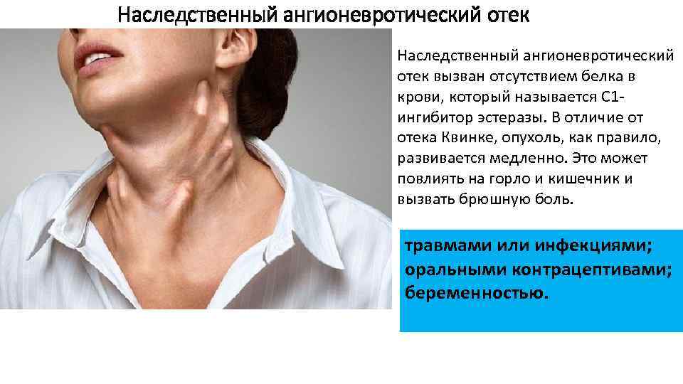 Наследственный ангионевротический отек вызван отсутствием белка в крови, который называется С 1 ингибитор эстеразы.