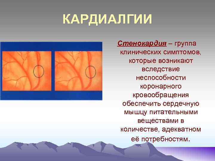 Кардиалгия. Симптомы кардиалгии. Кардиалгия что это такое симптомы. Кардиалгии и стенокардии. Функциональная кардиалгия.