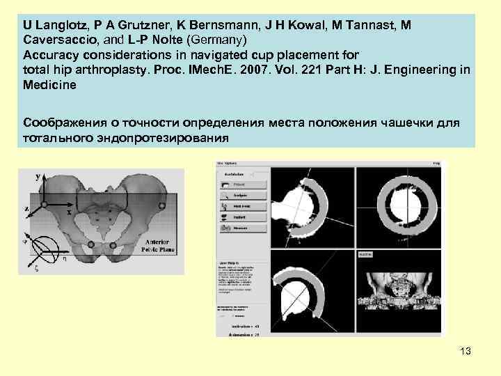 U Langlotz, P A Grutzner, K Bernsmann, J H Kowal, M Tannast, M Caversaccio,