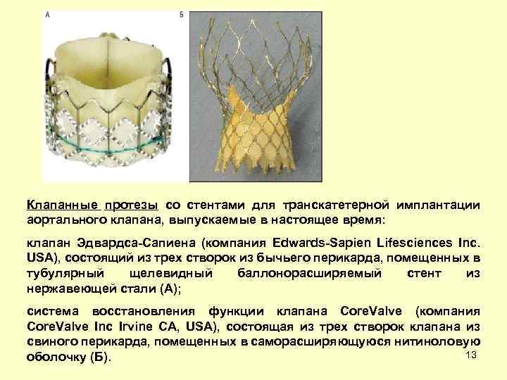 Клапанные протезы со стентами для транскатетерной имплантации аортального клапана, выпускаемые в настоящее время: клапан