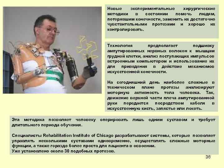 Новые экспериментальные хирургические методики в состоянии помочь людям, потерявшим конечности, заменить их достаточно чувствительными