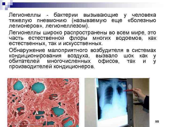 Легионеллы - бактерии вызывающие у человека тяжелую пневмонию (называемую еще «болезнью легионеров» , легионеллезом).