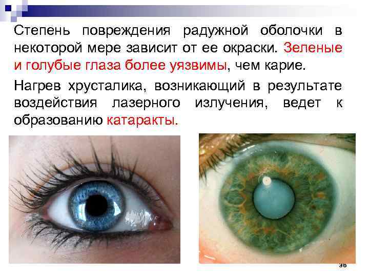 Степень повреждения радужной оболочки в некоторой мере зависит от ее окраски. Зеленые и голубые