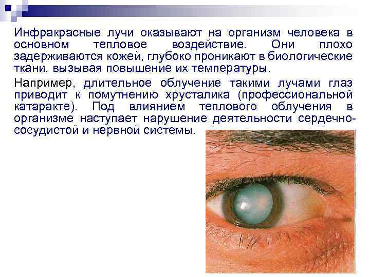 Инфракрасные лучи оказывают на организм человека в основном тепловое воздействие. Они плохо задерживаются кожей,