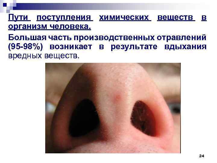 Пути поступления химических веществ в организм человека. Большая часть производственных отравлений (95 -98%) возникает