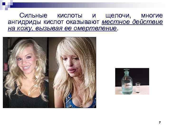 Сильные кислоты и щелочи, многие ангидриды кислот оказывают местное действие на кожу, вызывая ее