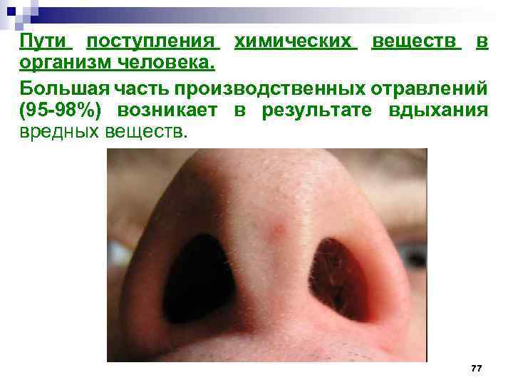 Пути поступления химических веществ в организм человека. Большая часть производственных отравлений (95 -98%) возникает