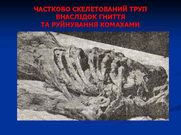 ЧАСТКОВО СКЕЛЕТОВАНИЙ ТРУП ВНАСЛІДОК ГНИТТЯ ТА РУЙНУВАННЯ КОМАХАМИ 