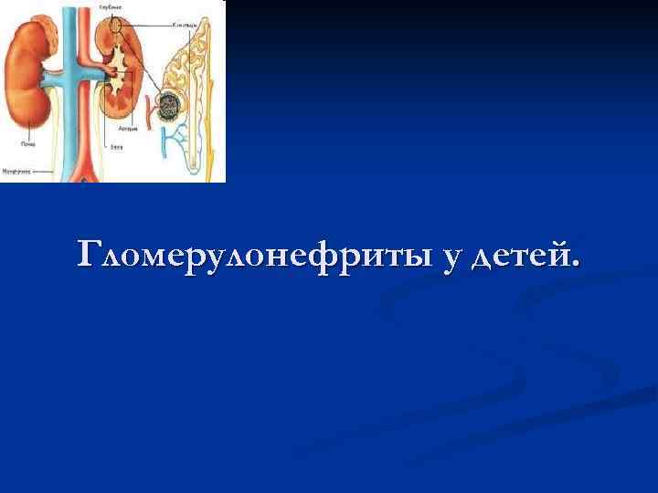 Гломерулонефриты у детей. 