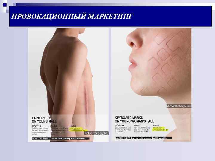 ПРОВОКАЦИОННЫЙ МАРКЕТИНГ 