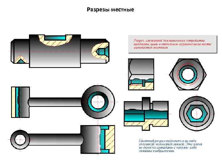 Разрезы местные 