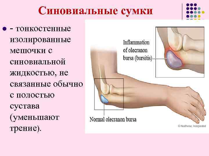  Синовиальные сумки l - тонкостенные изолированные мешочки с синовиальной жидкостью, не связанные обычно