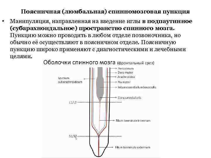 Набор инструментов для спинномозговой пункции