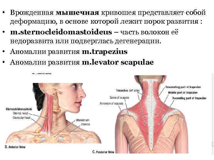 Операция при кривошее